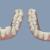 Invisalign braces dental treatment in Dubai UAE