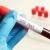 Trusted STD Testing Services Dubai – Private, Fast & Affordable