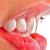 Hollywood Smile & Cosmetic Dentistry in Dubai UAE