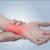 Best Rheumatologist Treatment Doctors in Dubai, UAE