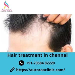 Hair treatment in Chennai