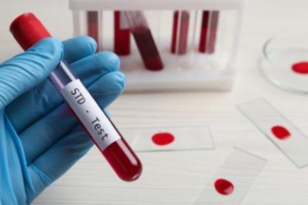 STD Testing Information Dubai 2025: What You Must Know Before Getting Tested