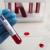 STD Testing Information Dubai 2025: What You Must Know Before Getting Tested
