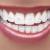 Ceramic braces dental treatment in Dubai UAE