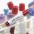 Reliable STD Test at Home Dubai – Private & Hassle-Free