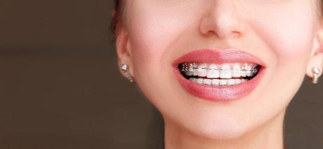 TMJ Disorder Treatment by Top Orthodontist Specialist in Dubai!