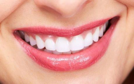 Hollywood Smile & Cosmetic Dentistry in Dubai UAE