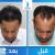 Tunio Aesthetics Hair Transplant